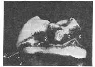 fig11.jpg (4722 bytes)